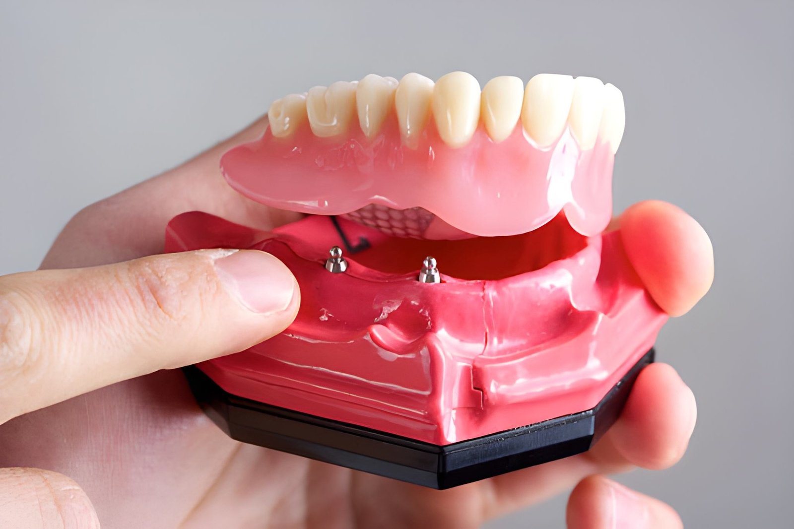 Dentures Treatment in UK